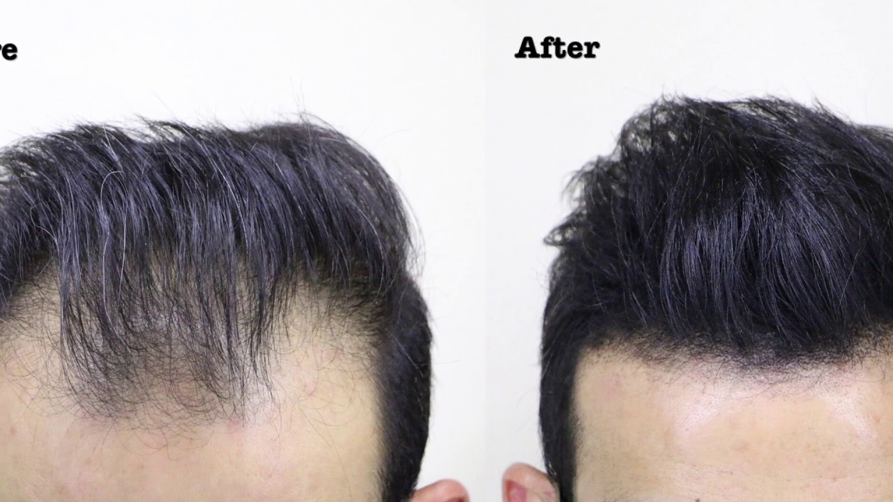 My Experience of Switching from Using Hair Fiber to A Men's Toupee