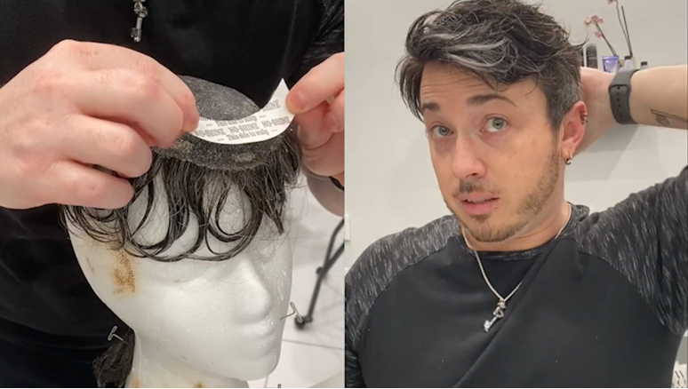 human hair replacement system tape