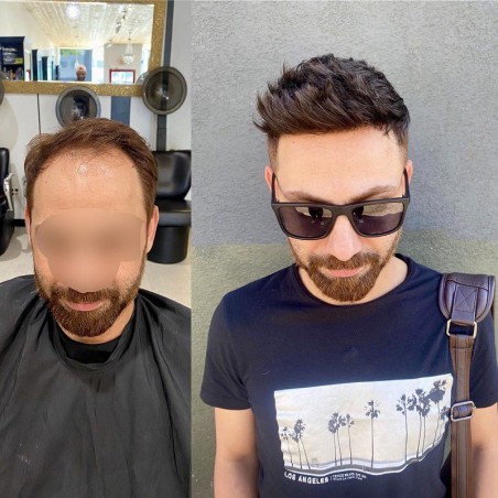 Helios Hair System for Bald Men |Full Swiss Lace Base |Best for Summer