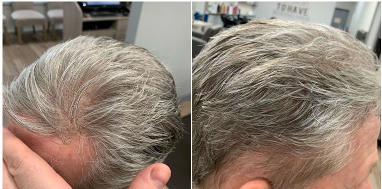 gray hair toupee