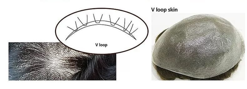 v-loop