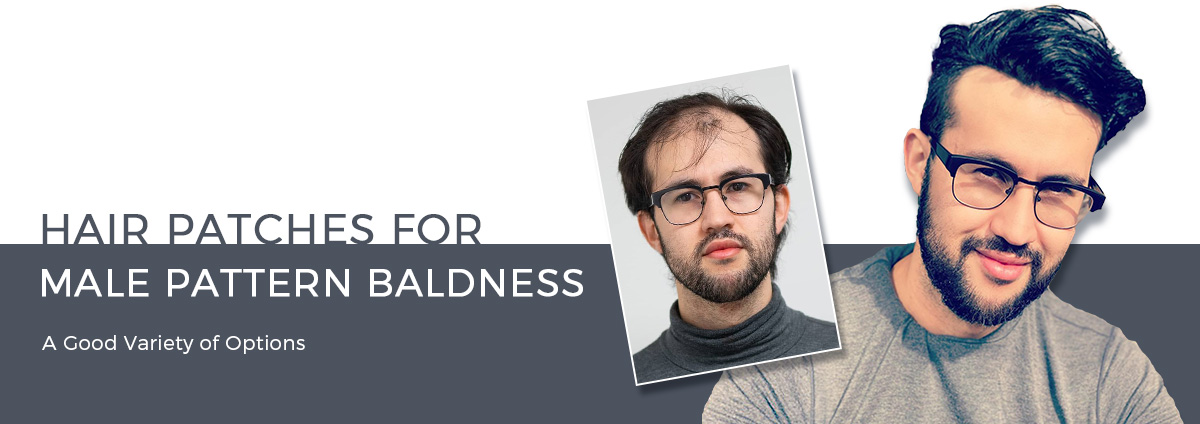 Hair Patches for Male Pattern Baldness - A Good Variety of Options